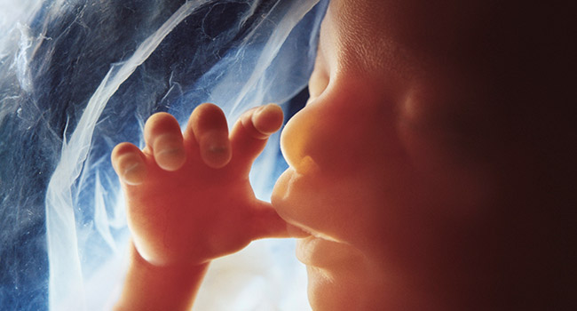 Abortion